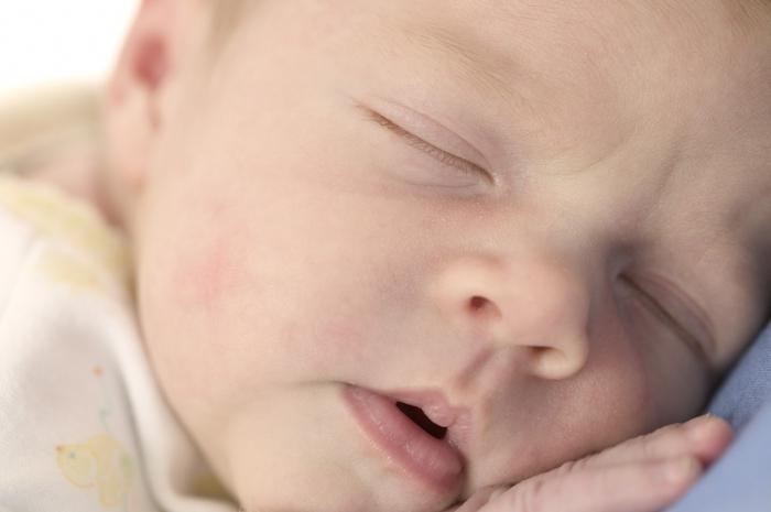 كيفية علاج سيلان الأنف في الرضيع