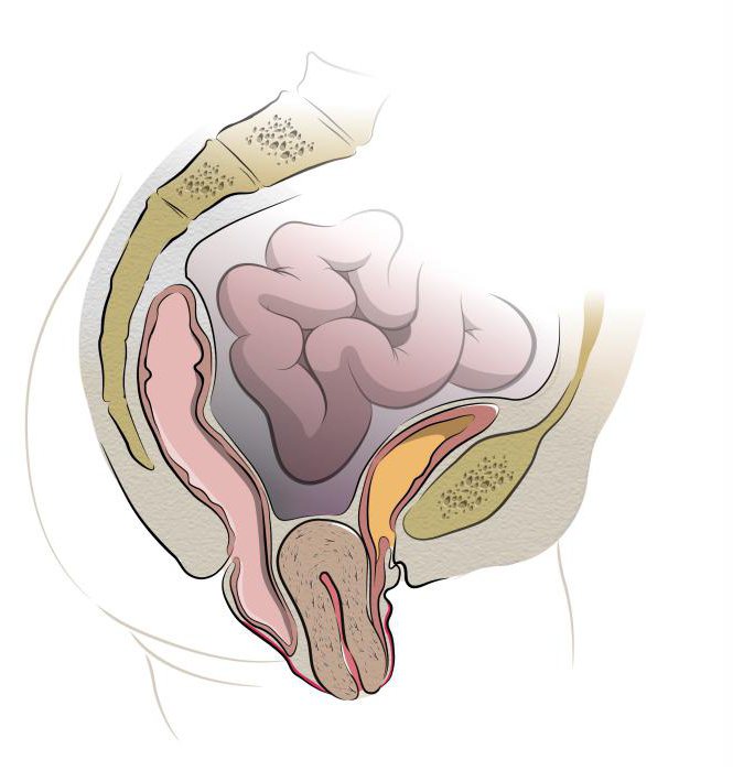 إغفال الرحم والأعراض والعلاج ، في سن 65 سنة